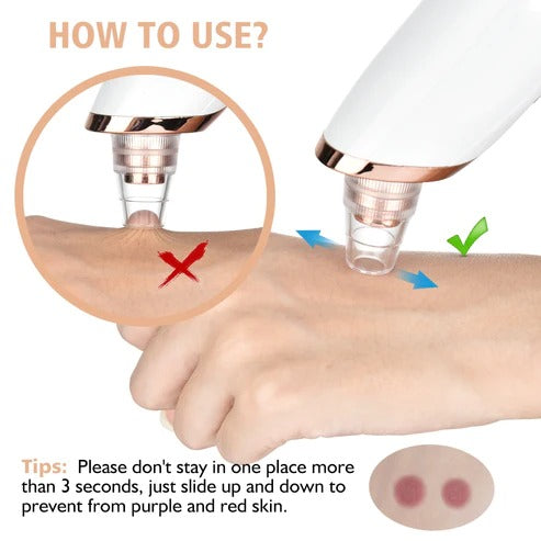 Multifunctional Cleaning Instrument For Pore Acne Pimple Removal and Vacuum Suction Facial Pore Cleaner