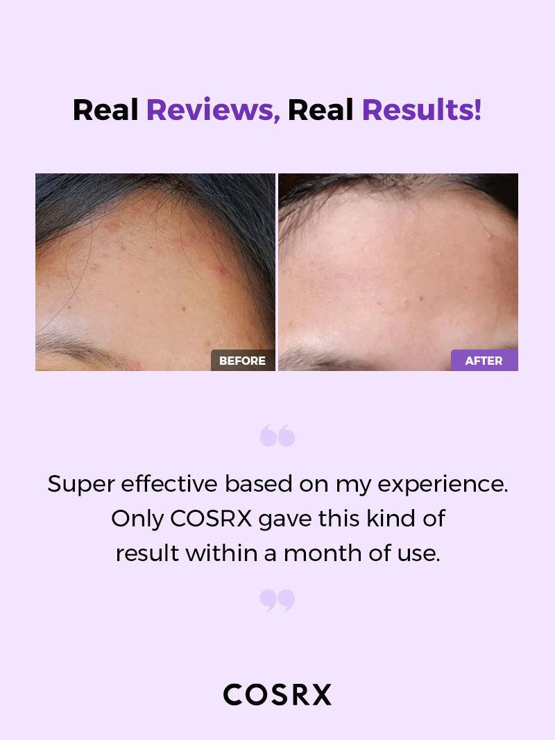Cosrx - AHA BHA Clarifying Treatment Toner/150ml